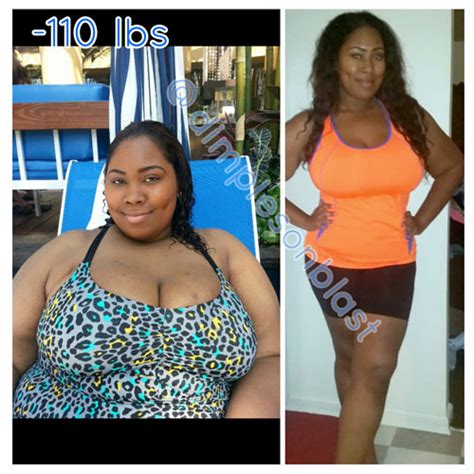 Naajma Lost 110 Pounds With Surgery And Hard Work Black