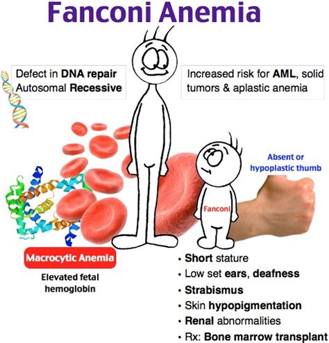 rosh review s adam rosh on twitter what type of anemia is fanconi