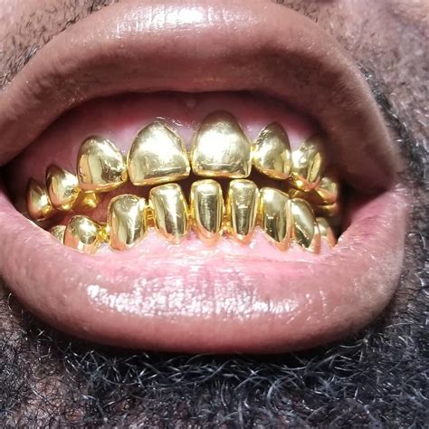 gold teeth  teethwalls