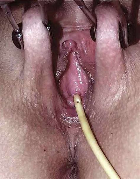 girl gets pee hole insertion image 4 fap
