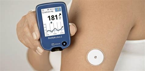 freestyle libre sensor monitoreo continuo de glucosa   mercado