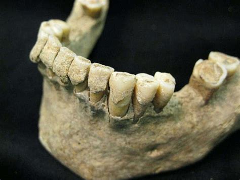 microbial tomb discovered   year  human teeth