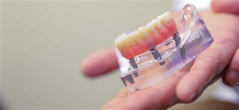 replace multiple missing teeth