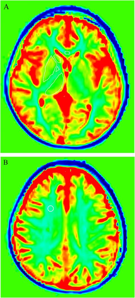 role   mapping  evaluate brain aging   healthy population clinical imaging
