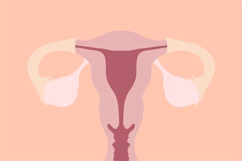 polycystic ovary syndrome symptoms treatments