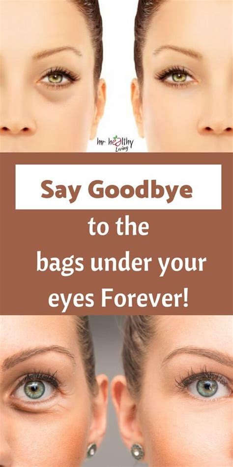 How Do You Get Rid Of Bags Under The Eyes