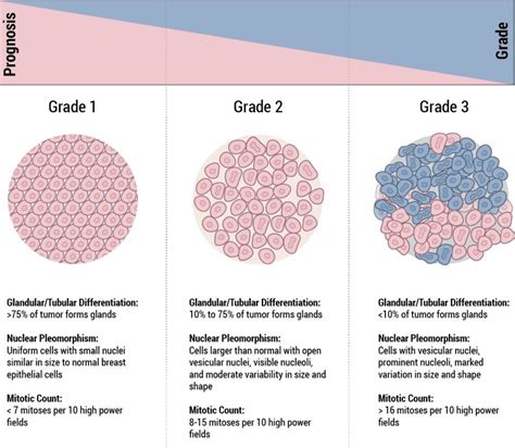 Staging And Grade Breast Pathology Johns Hopkins Pathology
