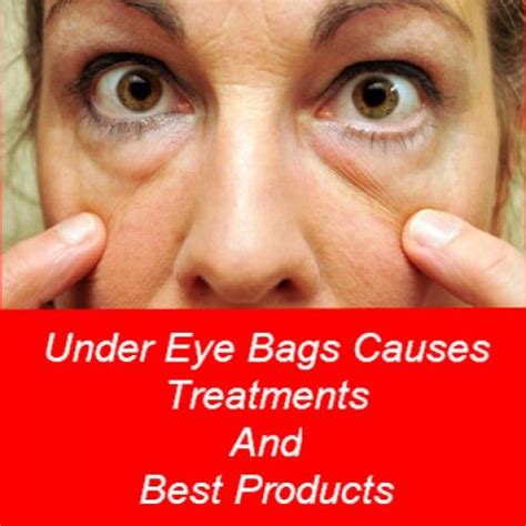 Under Eye Bags Treatments Causes And Best Cream Eye Bags Treatment