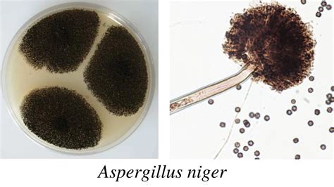 aspergillus morphology clinical features  lab diagnosis microbe