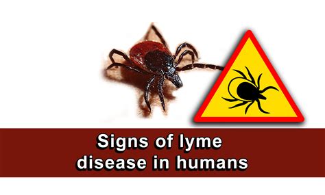 Signs Of Lyme Disease In Humans Health For Best Life