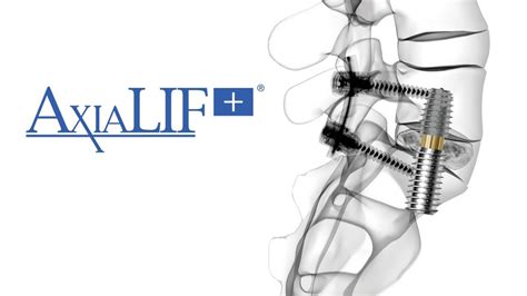axialif   spinal fusion procedure youtube