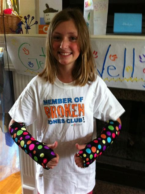 her daughter s broken arm became mom s lucky break arm cast broken arm cast cast covers arm