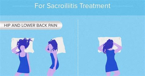 the best and worst sleeping positions for sacroiliitis treatment [infographic]