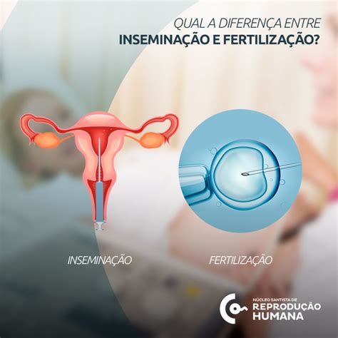 Qual A Diferença Entre Inseminação E Fertilização Núcleo Santista De