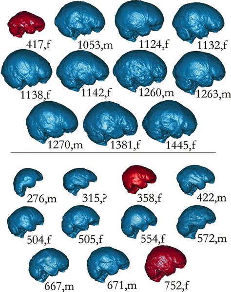 Brain Shape In Human Microcephalics And Homo Floresiensis