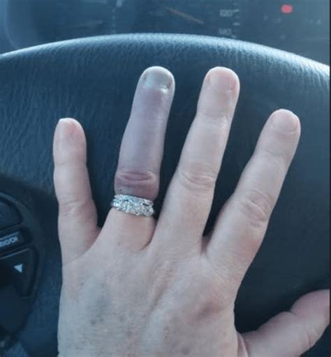 woman jams wedding ring on her finger and it goes so blue people reckon