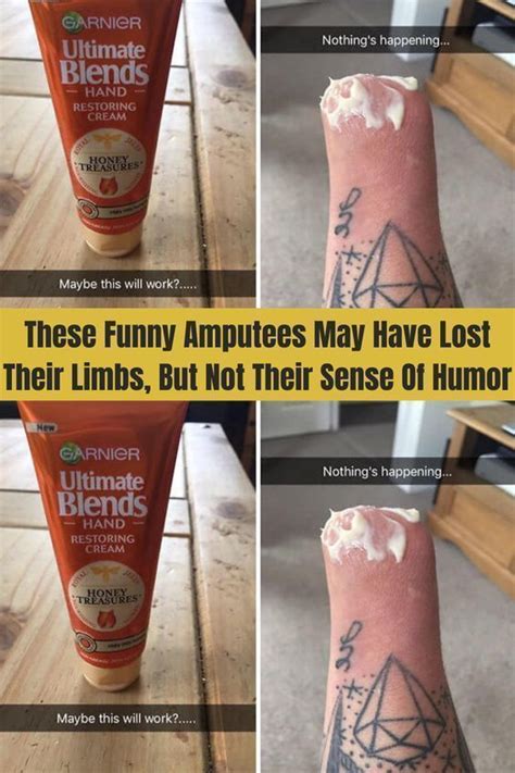 these funny amputees may have lost their limbs but not their sense of