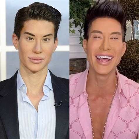 botched human ken doll is back hear about his 900 surgeries e