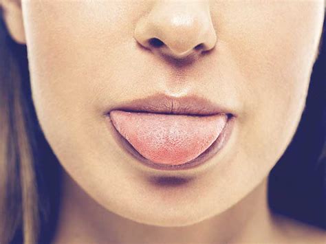Sweet Taste In The Mouth Symptoms Causes And Prevention