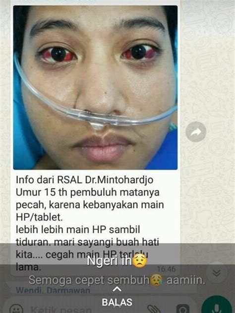 Populer 20 Pembuluh Darah Di Mata Pecah