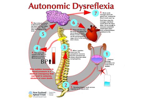 autonomic dysreflexia  zealand spinal trust