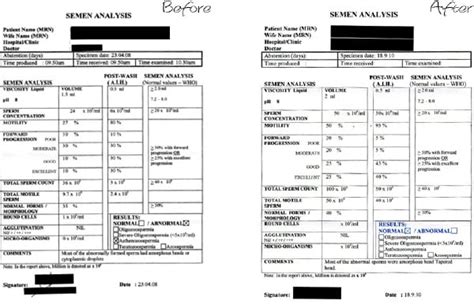 sperm ivf issue sex test advised clinic doctors wife porn movie