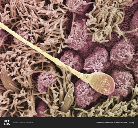 Magnification View Of A Sperm Cell Under A Color Scanning Electron