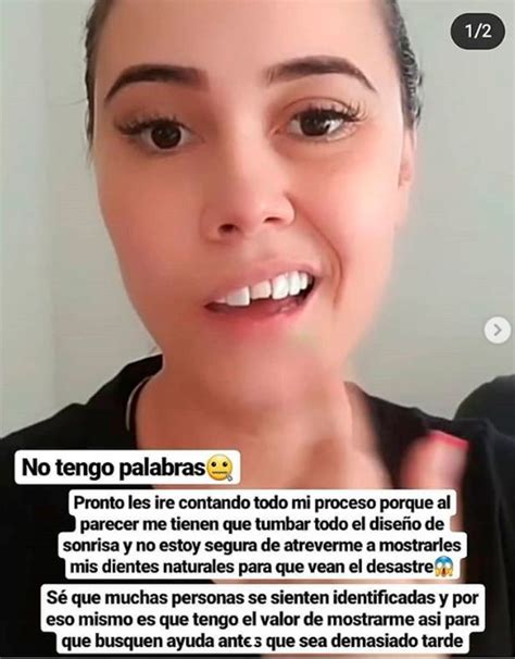 colombian influencer regrets veneers after she s left with