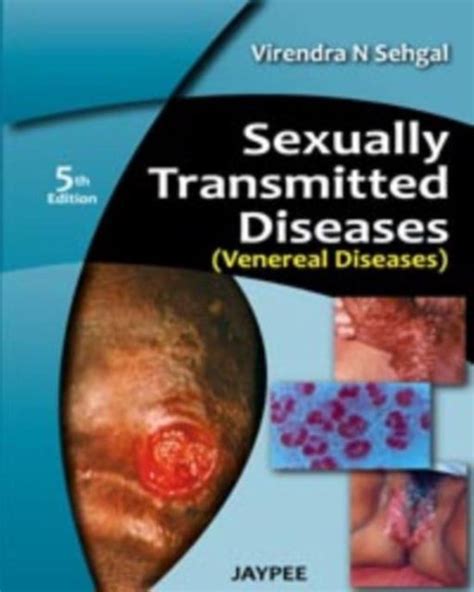 Sexually Transmitted Diseases Venereal Diseases