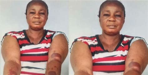 shocking story of a woman who was beaten to a pulp by