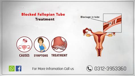 pin by buzzposts on health fallopian tube blockage fallopian tubes