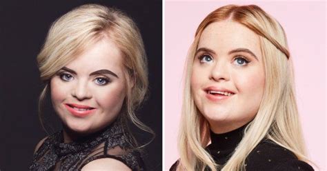 Model With Down S Syndrome Becomes Brand Ambassador For Benefit