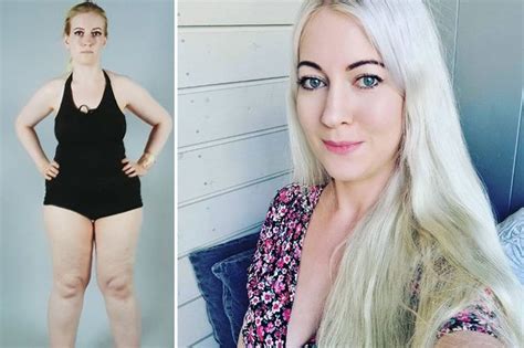 Woman Born With Male And Female Genitals Crowdfunds For Op After Docs