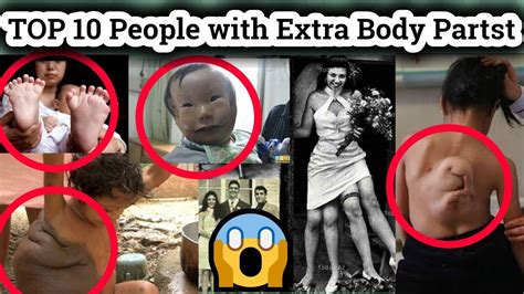 Top 10 People With Extra Body Parts Youtube