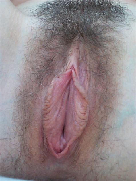 Vulva_and_pubic_hair  In Gallery Big Labia Pussy