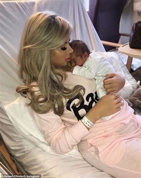 love island s hannah elizabeth defends c section makeover daily