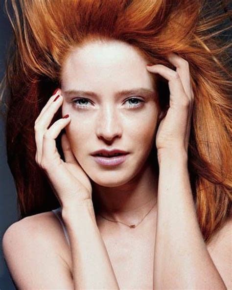 5 things every redhead should know when visiting a dermatologist — how