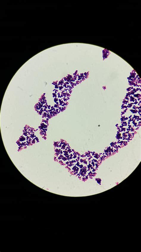 Micrococcus Luteus In A Veterinary Clinical Setting – Microbiology