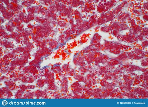 Human Liver Tissue Under The Microscope View Stock Image Image Of