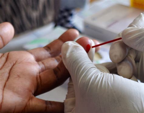 hiv prevention study finds universal test  treat approach