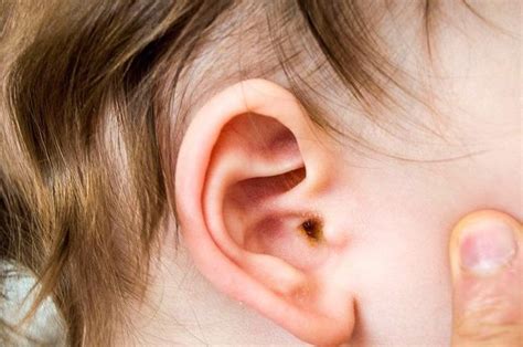 pengobatan rumahan mengatasi infeksi telinga  balita bebas rewel