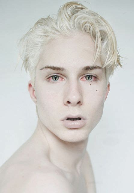 — fantasy albinism character inspiration albino men