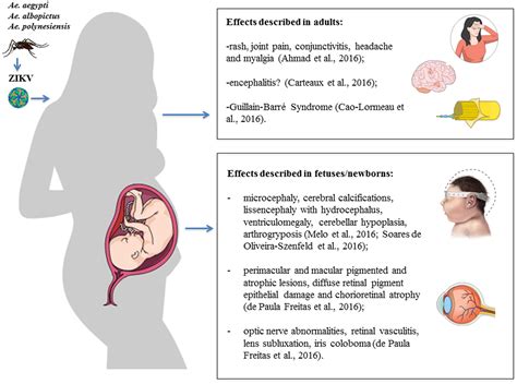 frontiers zika virus what have we learnt since the start of the recent epidemic microbiology