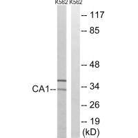 ca antibody sab signalway antibody