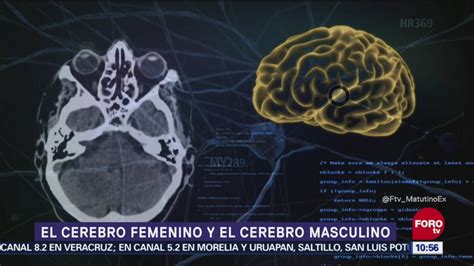 Diferencias Entre Cerebro Masculino Y Femenino Noticieros Televisa