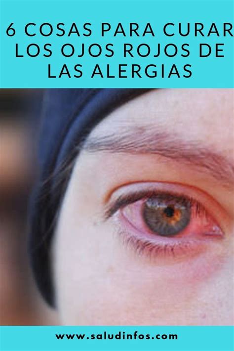 6 cosas para curar los ojos rojos de las alergias ojos rojos remedio