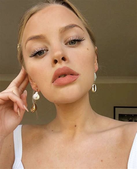 eastenders star hetti bywater hopes ‘scabs fall off after face peel