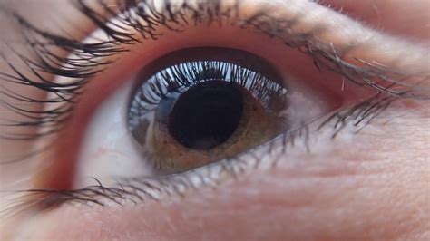 long      vision  clear   cataract
