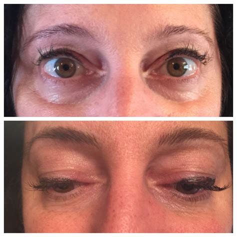 brows  thicker  arch corrected opens  eyes    lifted