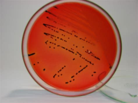 proteus xld bacterias em meio de cultura fotos cedidas ao flickr
